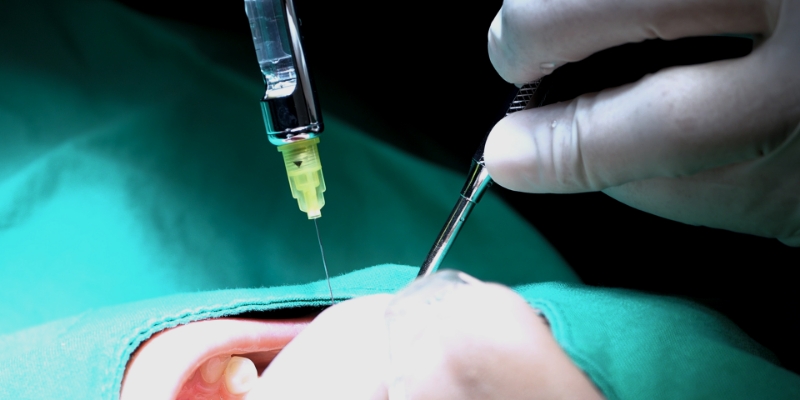 통증 및 붓기 완화를 위한 특별한 술기