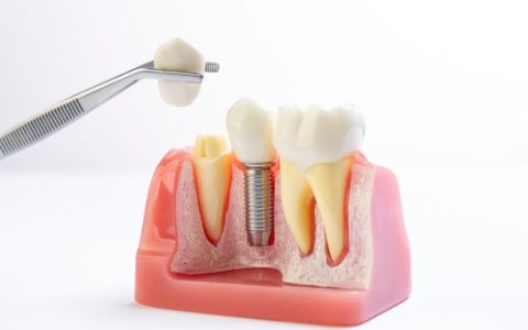 고난도 수술이 필요한 경우